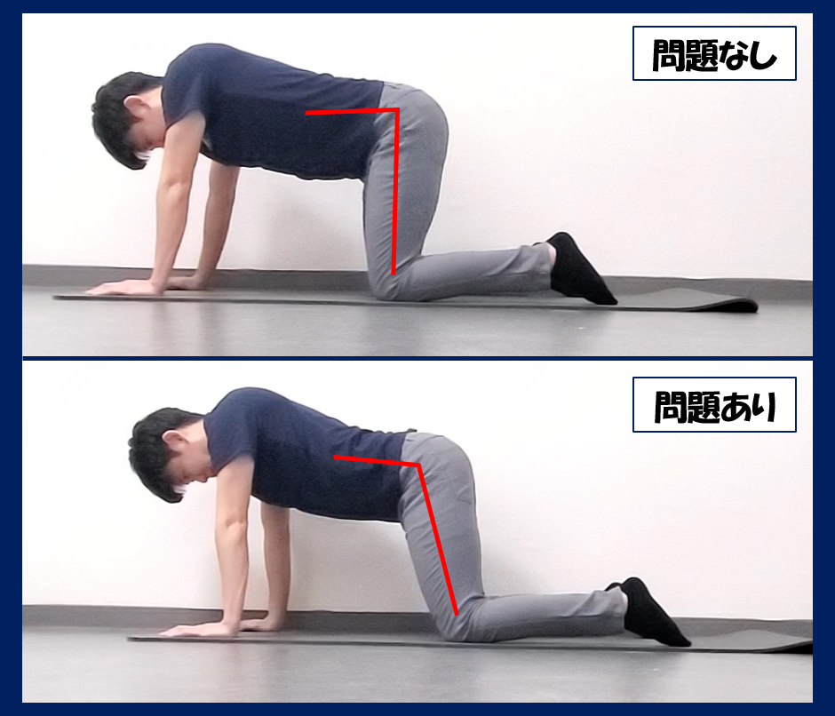 四つ這いチェック