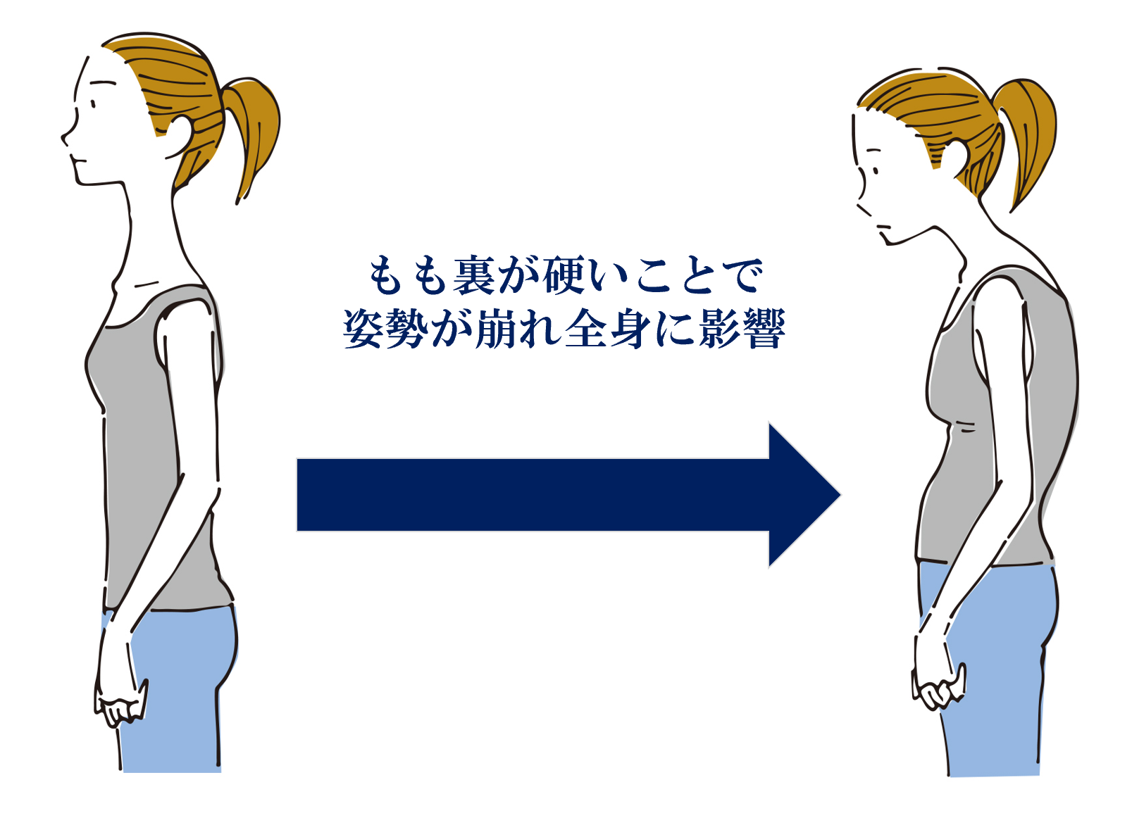 もも裏が硬いことによる影響